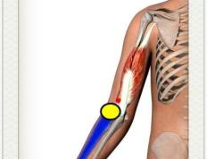 网球肘肱骨外上髁炎治法