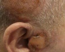 群里美女吧头道排毒的操作图片参考