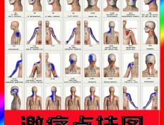 拔罐疗法的取穴整体思路讲解